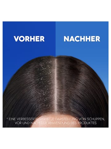 Head & Shoulders 3er-Set: Anti-Schuppen-Shampoos "Juckende Kopfhaut", je 500 ml