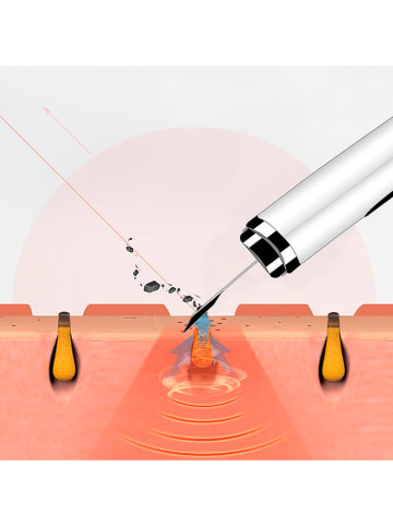 DAM Wysokoczęstotliwościowe urządzenie w kolorze białym do masażu twarzy