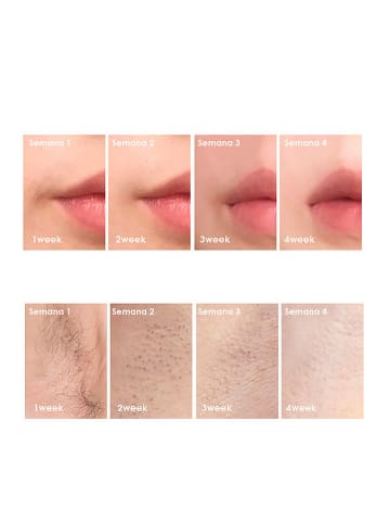 DAM Depilator IPL w kolorze turkusowym