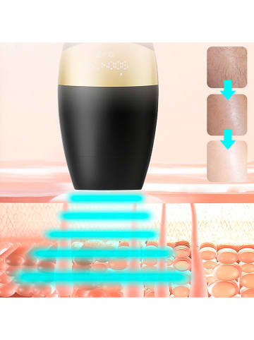 DAM IPL ontharingsapparaat zwart